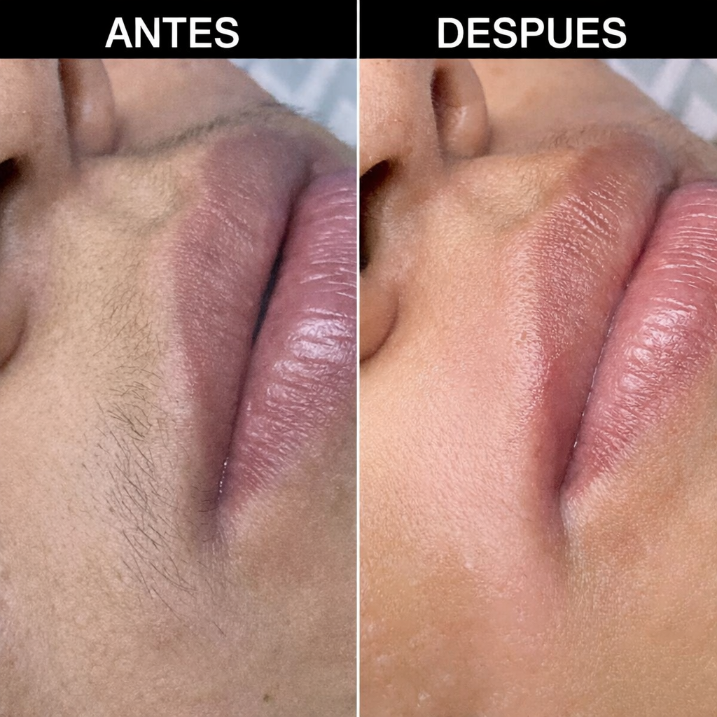 Elimina el vello facial al instante sin dolor, sin irritación y sin que vuelva más grueso