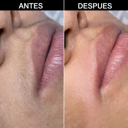 Elimina el vello facial al instante sin dolor, sin irritación y sin que vuelva más grueso