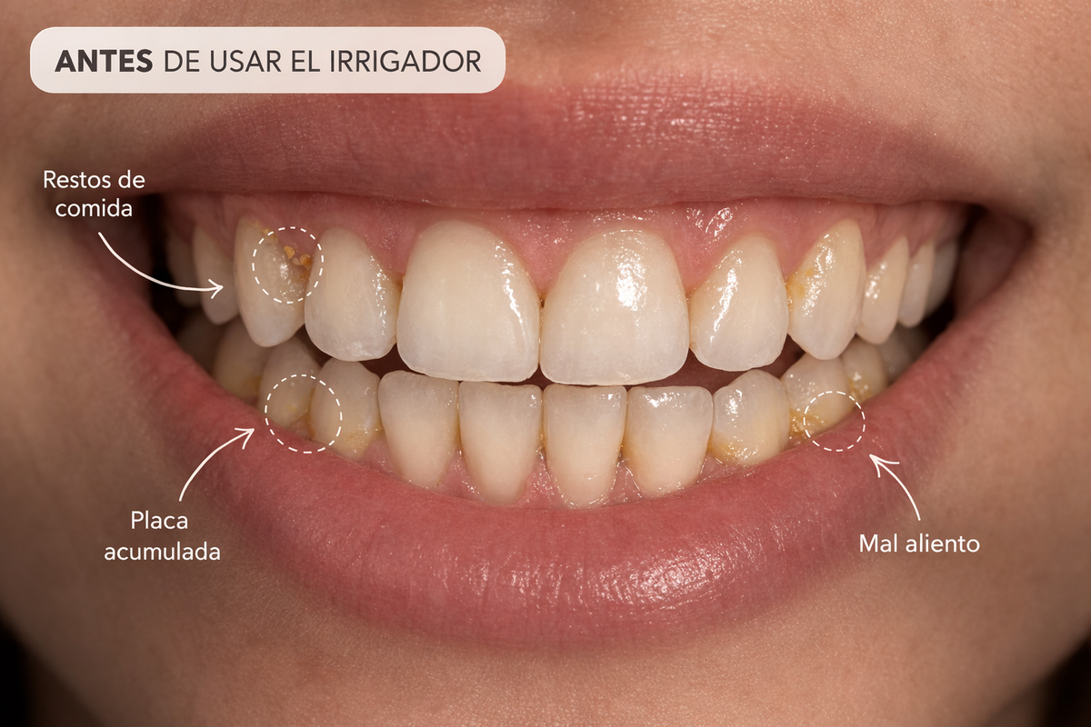 Antes